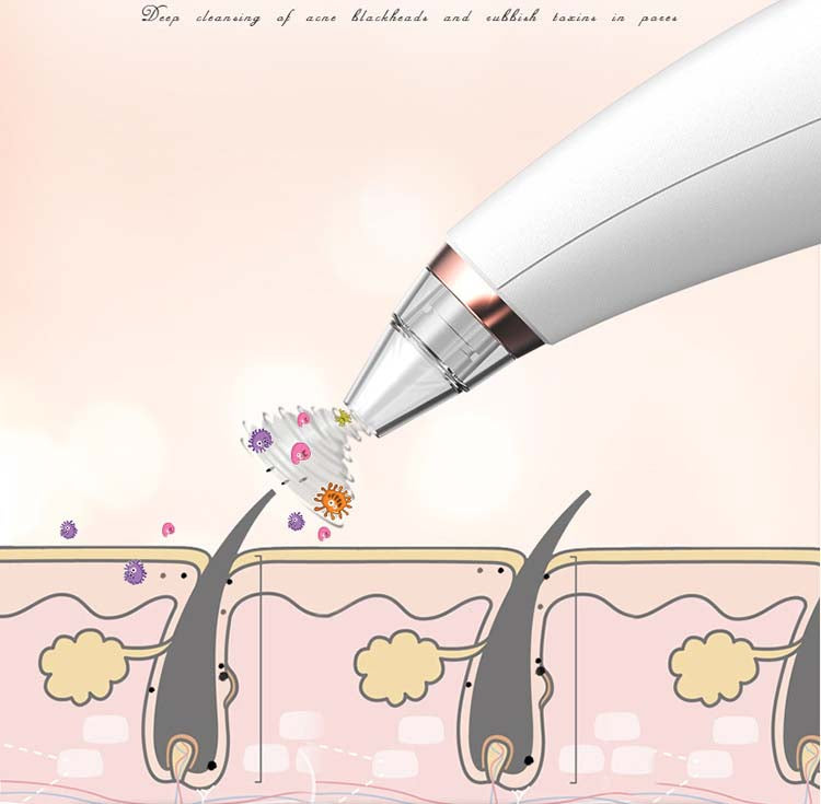 Effektiv porerenser - We Do Better